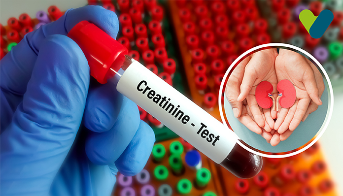 Creatinine