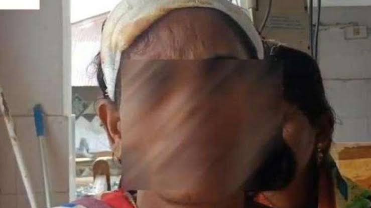 Dalit woman stripped